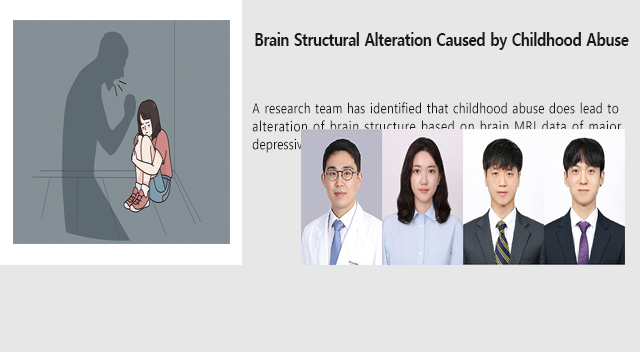 Brain Structural Alteration Caused by Childhood Abuse